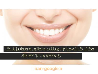 لته-جراح ایمپلنت های دندانی و دندانپزشک در تهران 
