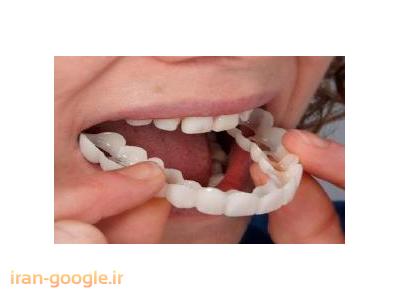 پلاک طبقه واحد-دندانسازی رحمت اله سهیلی ساخت پروتز ثابت و متحرک