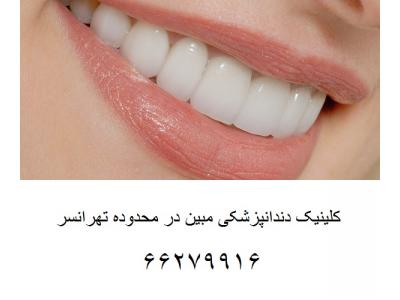 دندان سفید-افتتاح کلینیک دندانپزشکی مبین در محدوده تهرانسر 