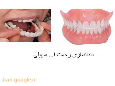 پلاک طبقه واحد-دندانسازی رحمت اله سهیلی ساخت پروتز ثابت و متحرک