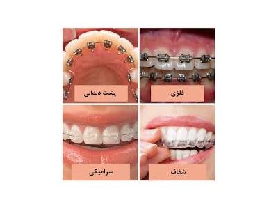متخصص درمان ریشه در غرب تهران-کلینیک دندانپزشکی دکتر محمدرضا معزز جراح ، دندانپزشک متخصص ایمپلنت در تهرانپارس