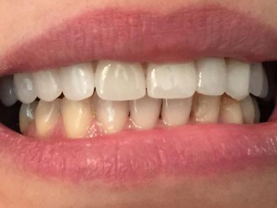 ارشد-مرکز کاشت دندان و زیبایی