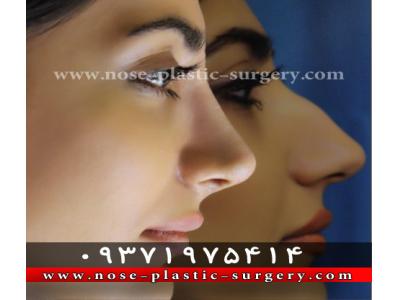 پروتز زیبایی-کلینیک جراحی بینی دکتر علی شهابی