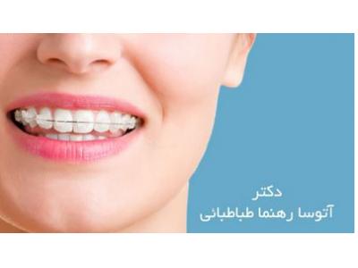 سفید کردن دندان-دکتر آتوسا رهنما طباطبائی ارتودنسی ثابت و متحرک