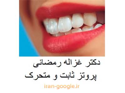 دندانپزشک متخصص-دکتر غزاله رمضانی متخصص پروتز ثابت و متحرک ، ایمپلنت و طراحی لبخند