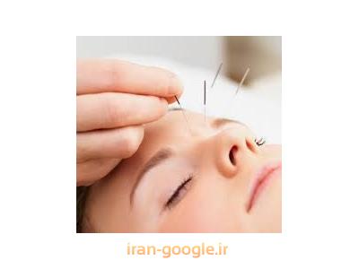 خدمات زیبایی و جوانسازی پوست-مرکز تخصصی طب سوزنی  فرمانیه 