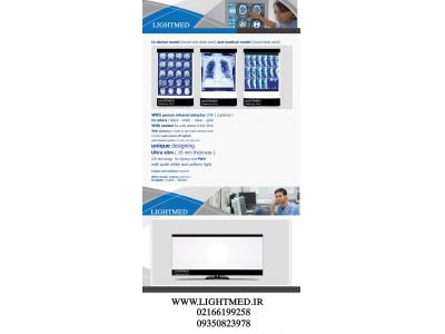 پخش کننده-چراغ نگاتوسکوپ(نگاتسکوپ ) پزشکی و دندانپزشکی دیجیتال