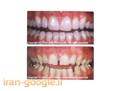 دندان سفید-مرکز تخصصی دندانپزشکی